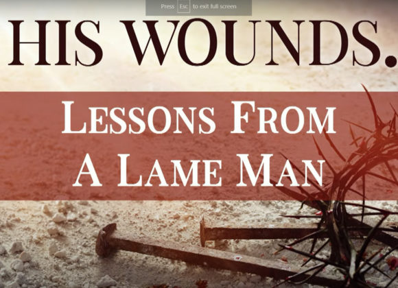 BY HIS WOUNDS – Lessons From A Lame Man
