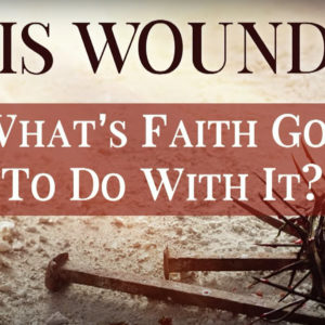BY HIS WOUNDS – What’s Faith Got To Do With It?