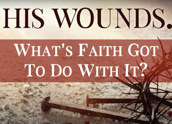 BY HIS WOUNDS – What’s Faith Got To Do With It?
