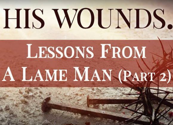 BY HIS WOUNDS – Lessons From A Lame Man – Part 2